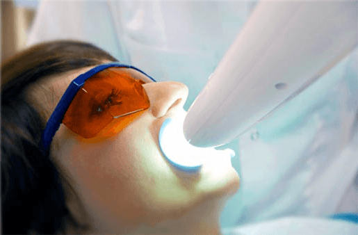 Understanding the Causes of Teeth Sensitivity Winchester