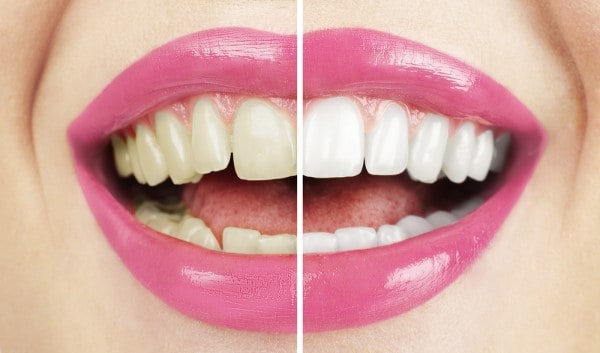 What Early Signs of Oral Cancer Should You Never Ignore Winchester?