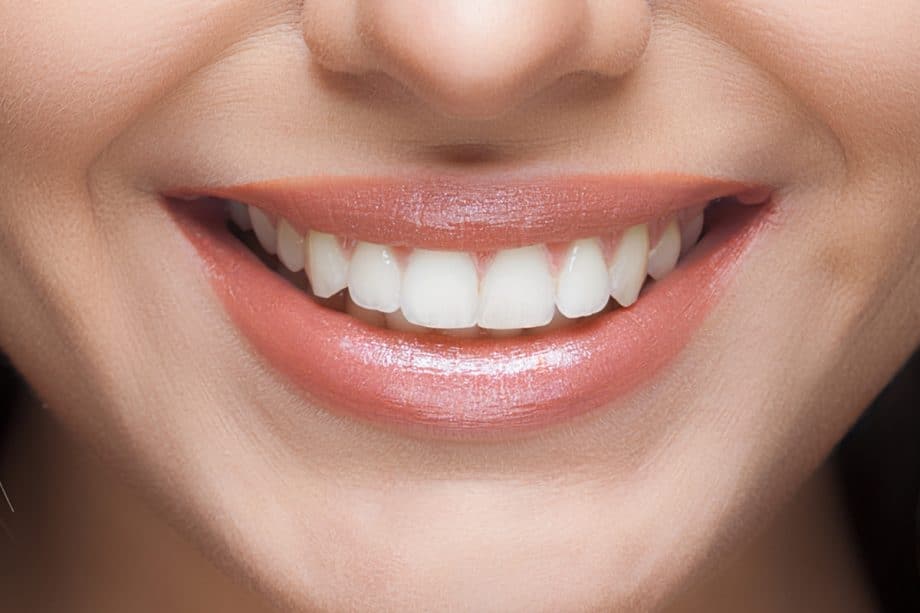 Smart Daily Habits to Protect Your Enamel Winchester