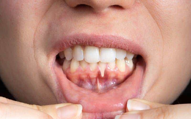 Final Thoughts: Building Lifelong Enamel Protection Habits Winchester