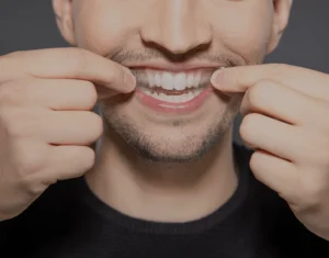 Overview of Home Teeth Whitening Kits Winchester