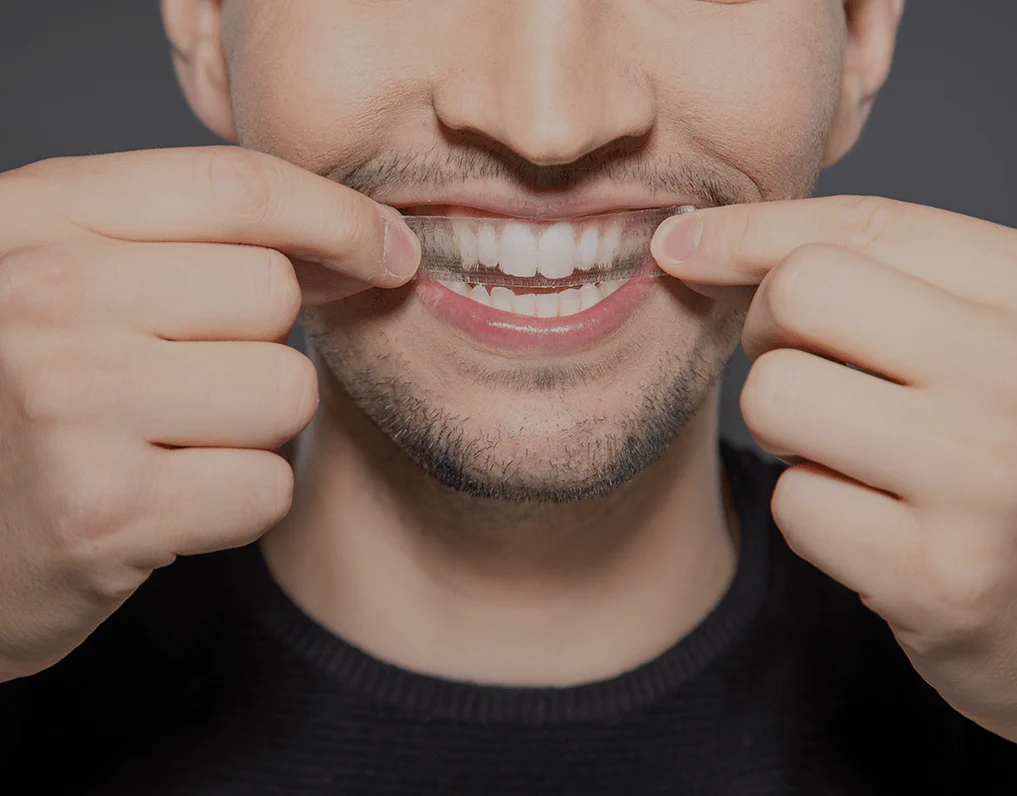 Can You Whiten Natural Teeth Without Harsh Chemicals Winchester?