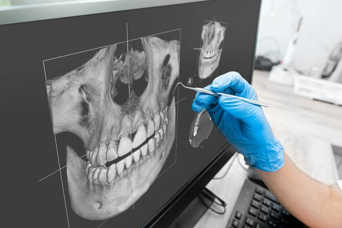 Key Benefits of 3D Printing for Patients and Dentists Winchester