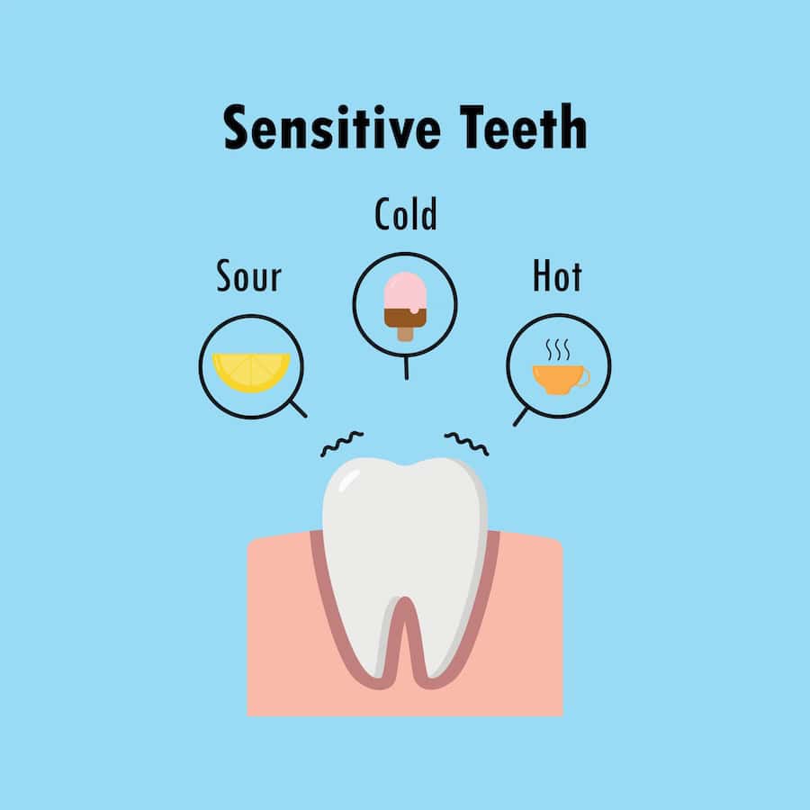 Why Do Teeth Become Sensitive After Whitening Treatments Winchester?