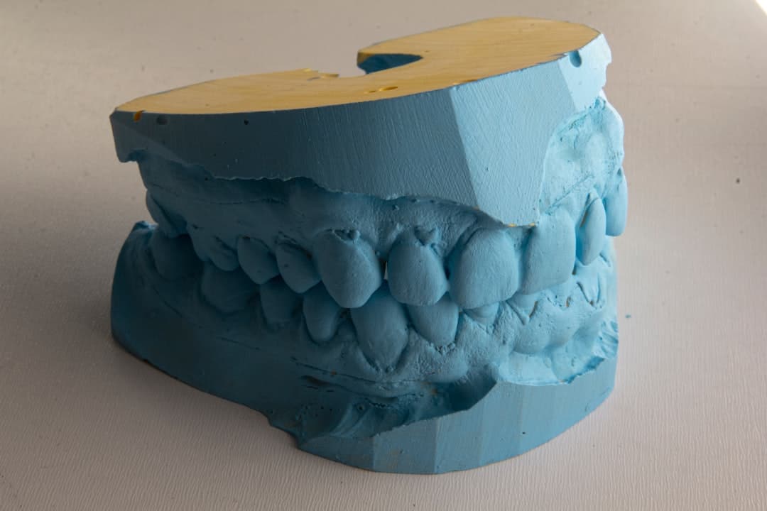 How Do Dental Implants Improve Jawbone Health and Oral Function Winchester?