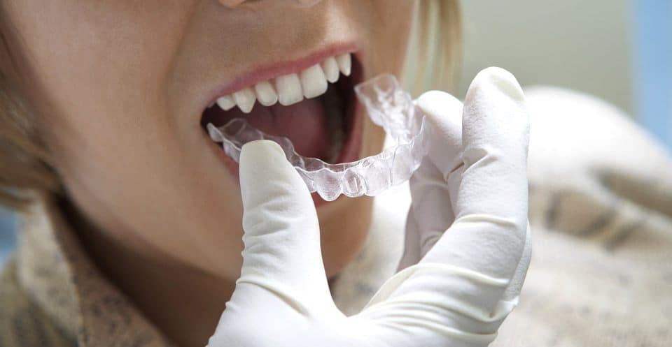 Can Bruxism Affect Your Sleep Quality Winchester