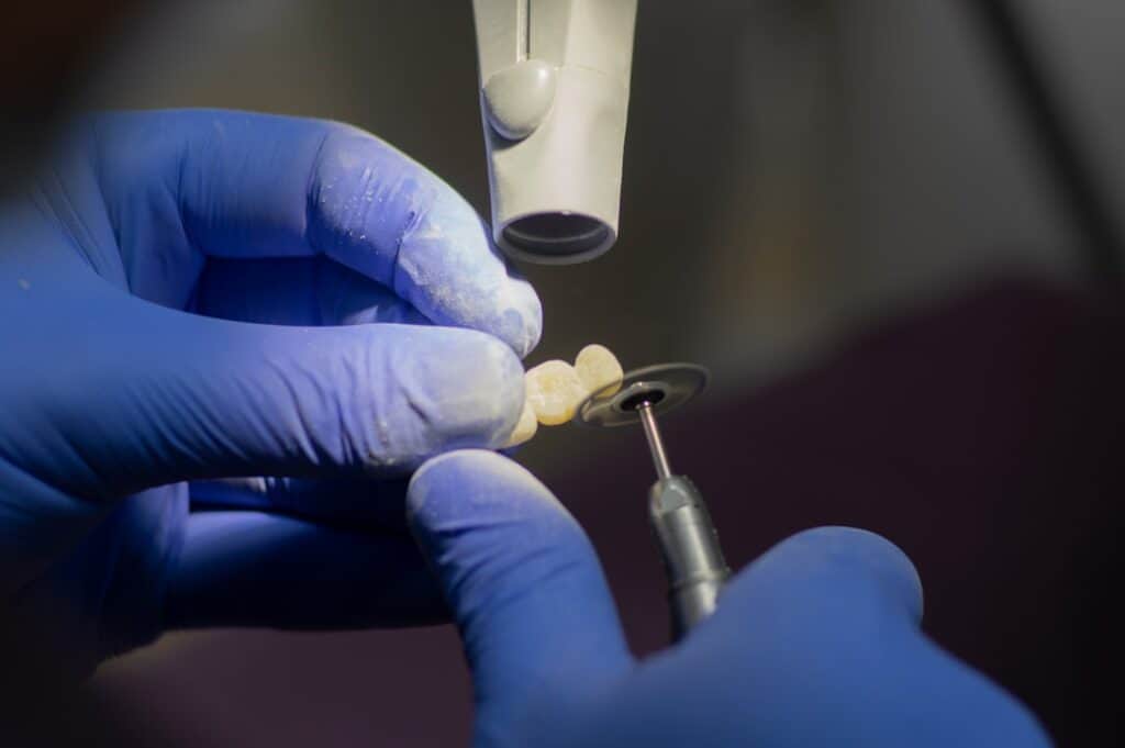 Customised Dental Solutions: Crowns, Aligners, and Implants Winchester